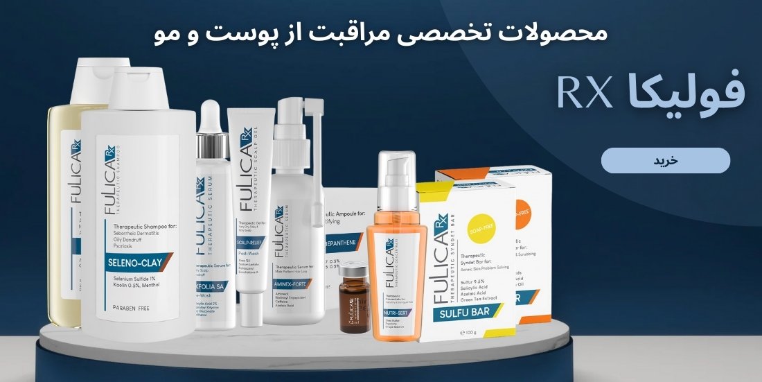 انواع ساعت مچی